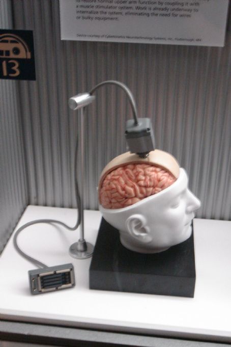 Brain–computer interface