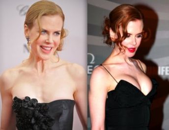 Did Nicole Kidman get breast implants FamousFix post