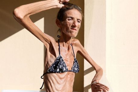 Life And Death Of The Skinny Woman On The Planet
